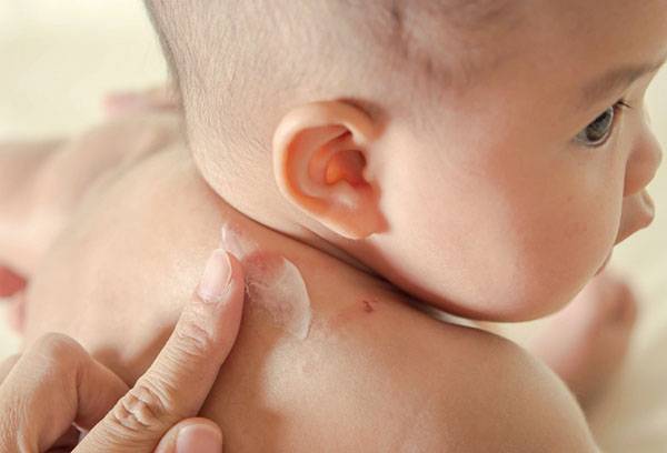 Reazione allergica in un bambino