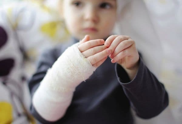 Un bambino con un'ustione delle sue mani